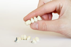 Bridges Dental Bridges Logan Utah